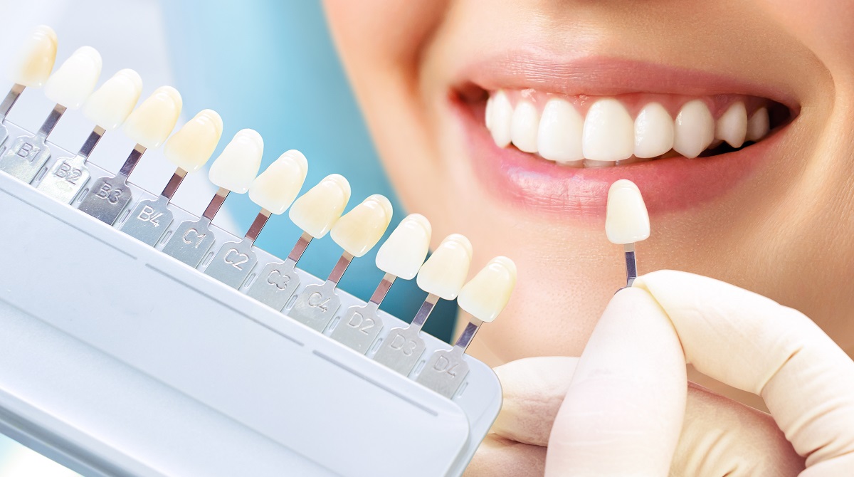 当院のセラミック治療