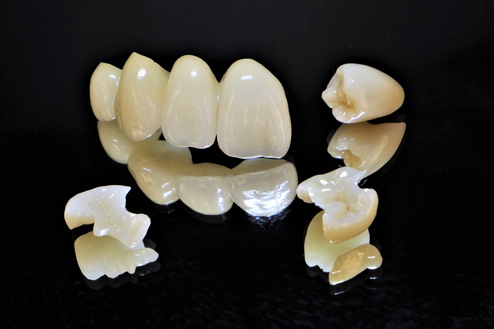 オールセラミック