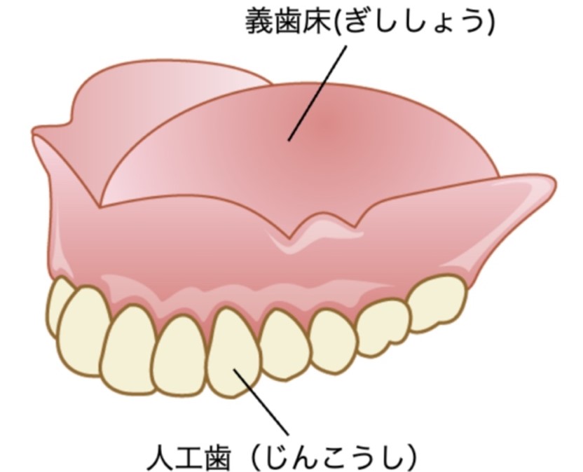総義歯（総入れ歯）
