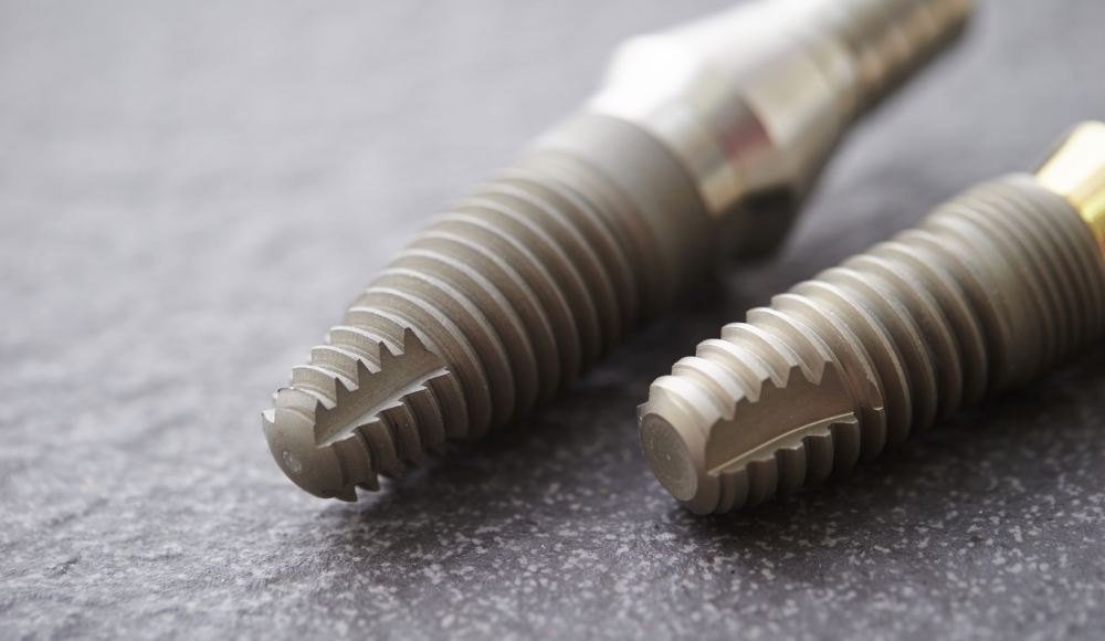 インプラントとは？